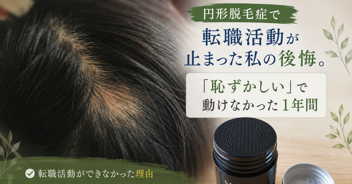 円形脱毛症と転職活動が止まった alopecia-areata-job-hunting